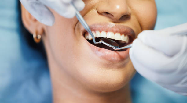 Best Broken or Cracked Tooth Emergency Dentist in Marengo, IA