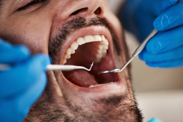 Best Emergency Root Canal Treatment in Marengo, IA